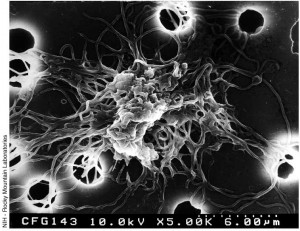 Borrelia burgdorferi. Imagen de microscopia electrónica de barrido, magnificado 7-10,000 X. Lyme Disease Foundation