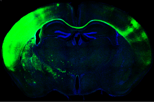 Sección de cerebro de ratón al microscopio. En verde las neuronas que cruzan de un hemisferio a otro formando el cuerpo calloso. / Laboratorio de Marta Nieto. CNB-CSIC
