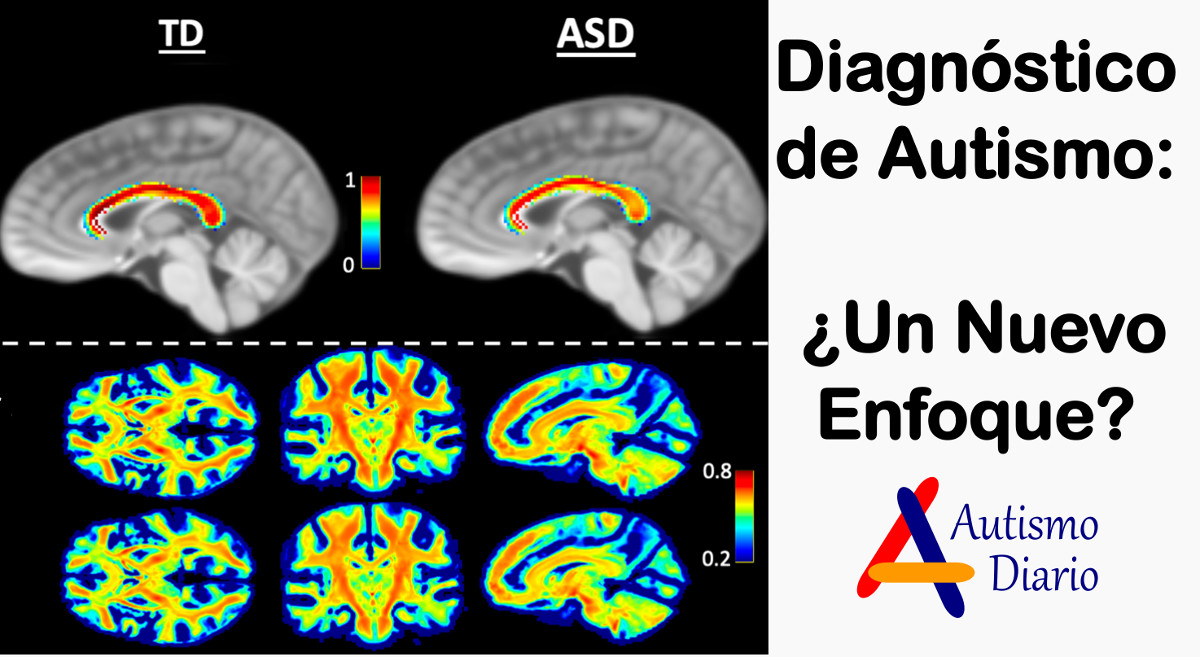 diagnóstico de autismo