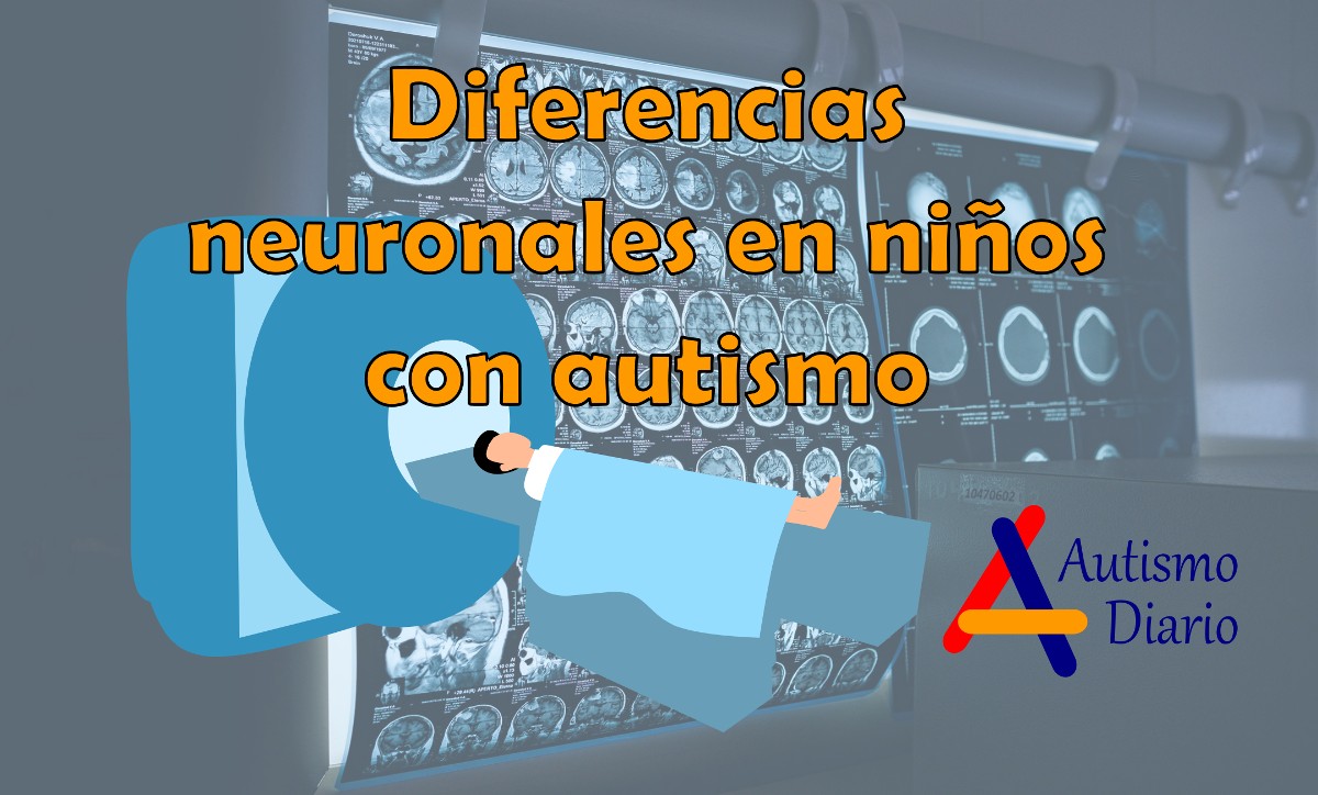 Diferencias neuronales en niños con autismo